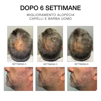 Diego Dalla Palma HC Estremirimedi Serum 6 Saç Derisi ve Saç Güçlendirici Bakım 50 Ml - 5