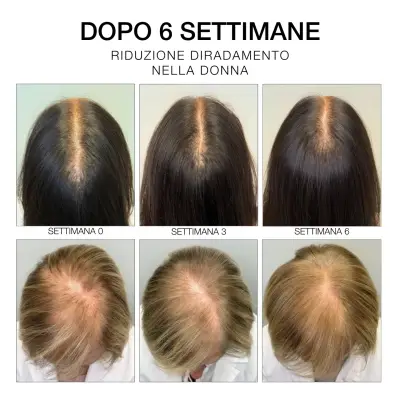 Diego Dalla Palma HC Estremirimedi Serum 6 Saç Derisi ve Saç Güçlendirici Bakım 50 Ml - 4