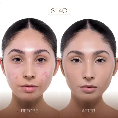 Diego Dalla Palma MU Fondöten Nudissimo Serum Satin Spf30 - 314 - 2