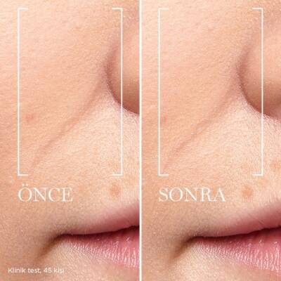 Lancome Renergie Triple Serum 20 Ml - 4